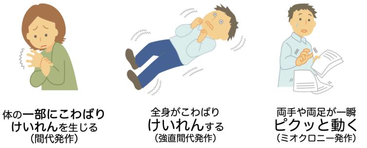 ジャクソン発作の症状