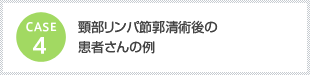 ケース4　頸部リンパ節郭清術後の患者さんの例