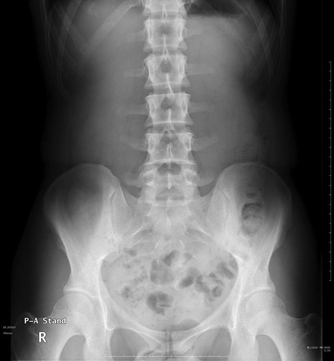 一般撮影 放射線部 神戸大学医学部附属病院