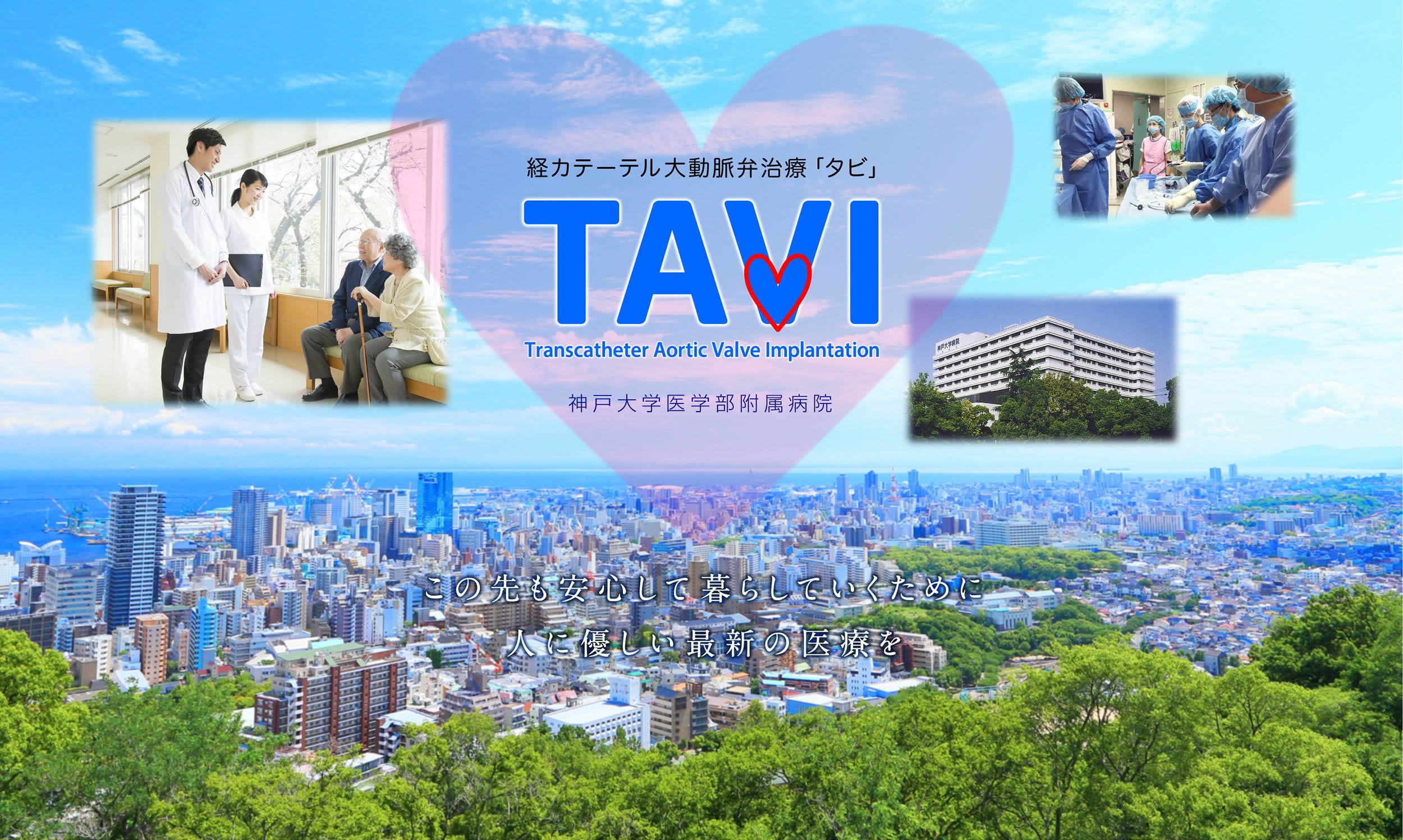  alt="TAVI(タビ) 経カテーテル大動脈弁治療 / 神戸大学医学部附属病院"