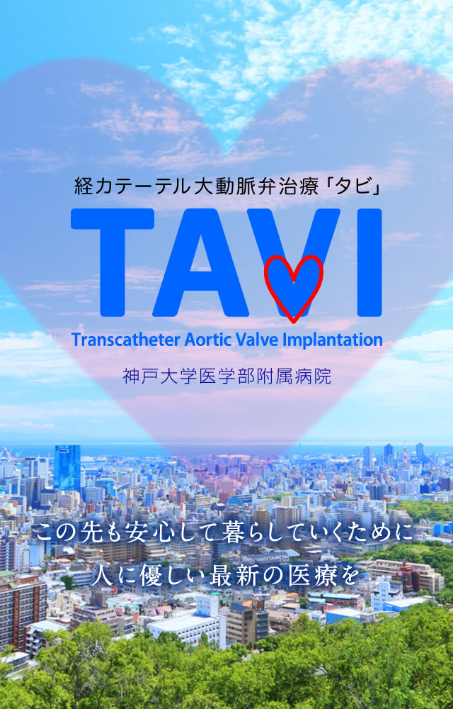  alt="TAVI(タビ) 経カテーテル大動脈弁治療 / 神戸大学医学部附属病院"